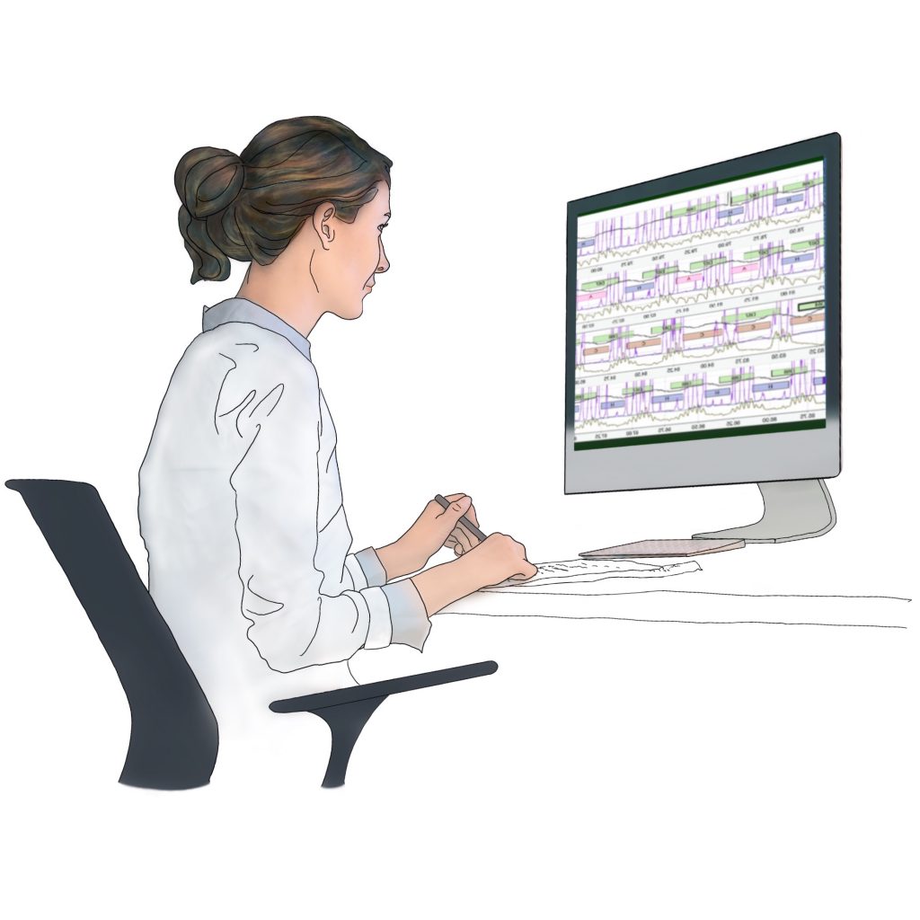 Un dibujo de un técnico (RPSGT) en Snap Diagnostics analizando datos del sueño de una prueba del sueño en casa para apnea